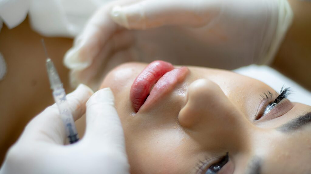 Close-up of a woman receiving a lip augmentation with a syringe by a professional.